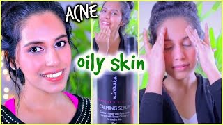 ACNE or OILY Skin Natural Skin Care Routine (Ayurvedic)